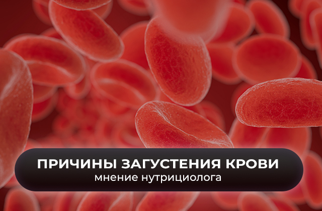 «Густая кровь». Каковы причины этого состояния и что с этим можно сделать. Мнение нутрициолога «Густая кровь». Каковы причины этого состояния и что с этим можно сделать. Мнение нутрициолога