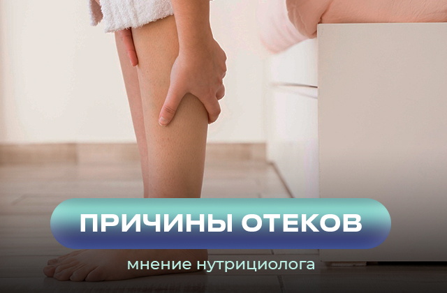 Наиболее частые причины отеков как от них избавиться. Мнение нутрициолога