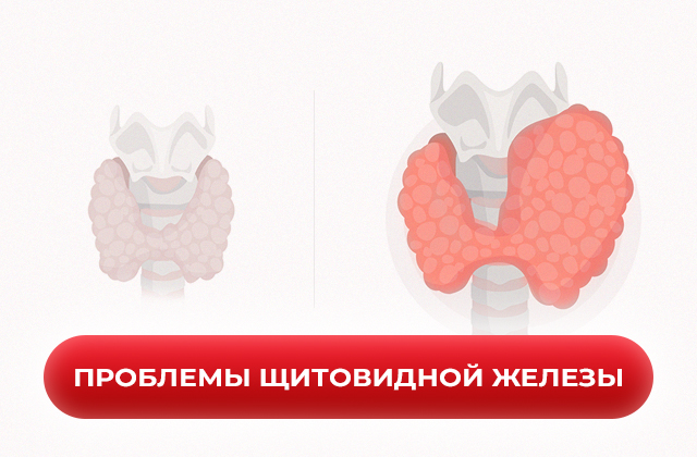Проблемы щитовидной железы и их влияние на общее здоровье и метаболизм Проблемы щитовидной железы и их влияние на общее здоровье и метаболизм
