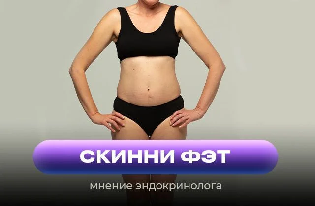 Фигура «скинни фэт» и что с этим делать